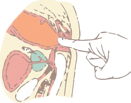 Illustration of a digital rectal exam